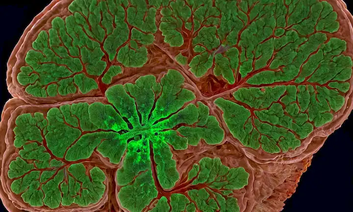 Rebanada de cerebro 3D con racimos de placa amiloidea, proteína fluorescente verde que resalta acumulación, superficie cortical arrugada, enredos neurofibrilares obscurecidos, venas cerebrales pálidas y bolsillos de líquido cefalorraquídeo sutil