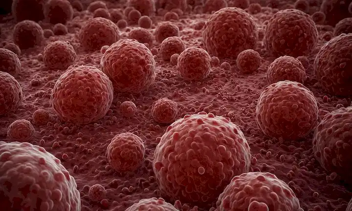Una visión microscópica, una estructura celular, células de leucemia se multiplican rápidamente, los glóbulos rojos están sobrepoderados, espacios blancos con manchas oscuras, un tono rojo dominante, un sentido del caos y el desorden