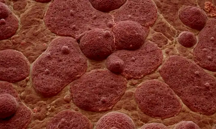 Invasión celular, migración de células tumorales, vasos sanguíneos, células cancerosas que cruzan el endotelio, vasos linfáticos, órganos distantes, colonias metastásicas, crecimiento de tejidos neoplásicos, lesiones cancerosas, masas tumorales, enfermedad de propagación